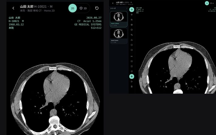 同じ画面をiPhoneとiPadで開いたデモ